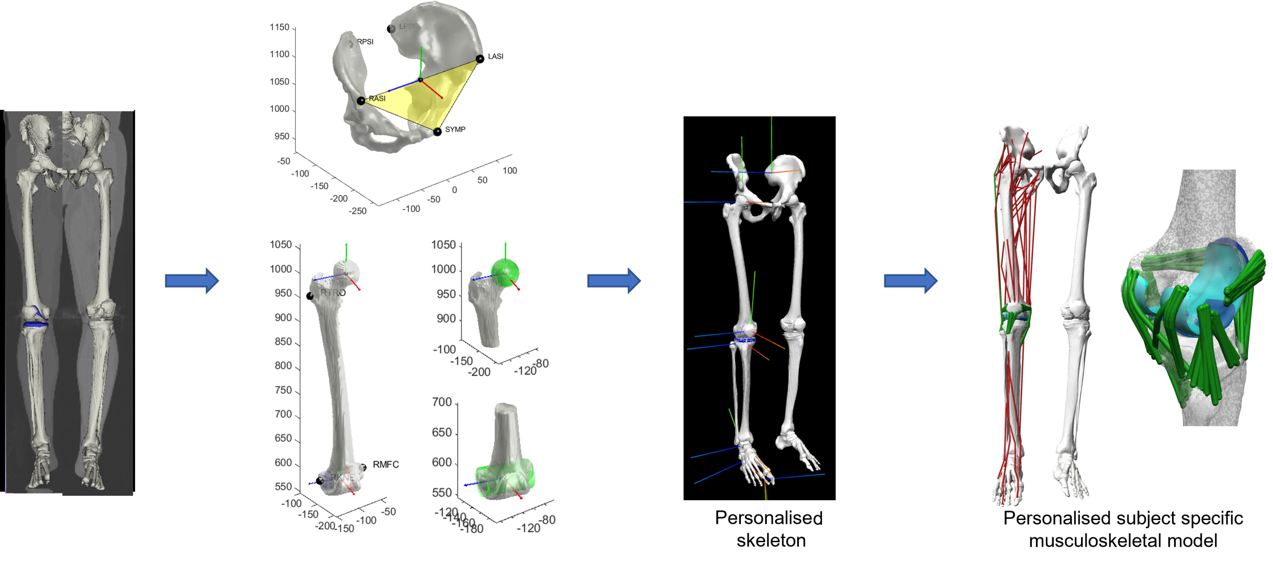 Enlarged view: Subject-specific modelling of total knee arthroplasty